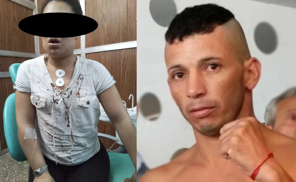 Ringuelet: Campeón sudamericano de boxeo golpeó brutalmente a su exnovia y le fracturó la mandíbula