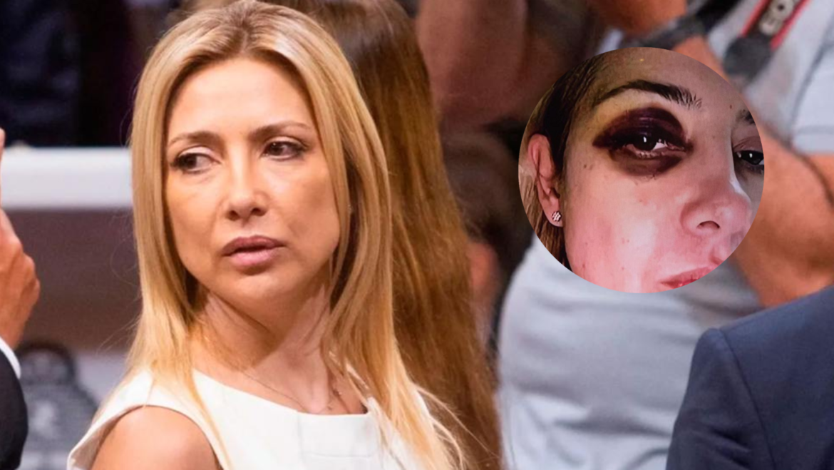 Fabiola Yañez: ‘Mucha gente sabía de esto’, ‘Cuando estaba de 8 meses de embarazo me agredía en el piso’