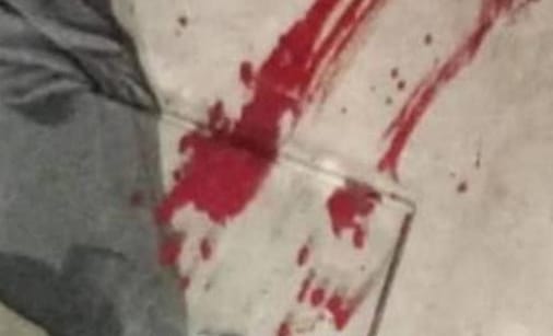 City Bell: una mujer atacó a su pareja con un cuchillo tras una discusión