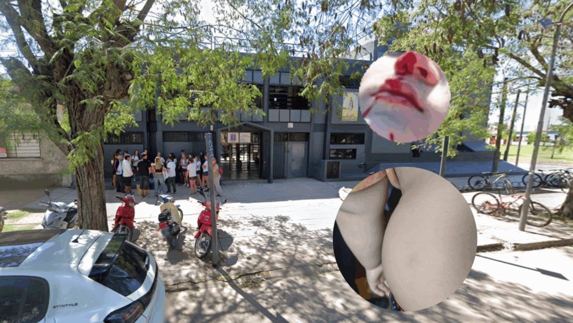 Chascomús: una familia denunció que su hijo de 6 años es víctima de bullying y agresiones en la escuela