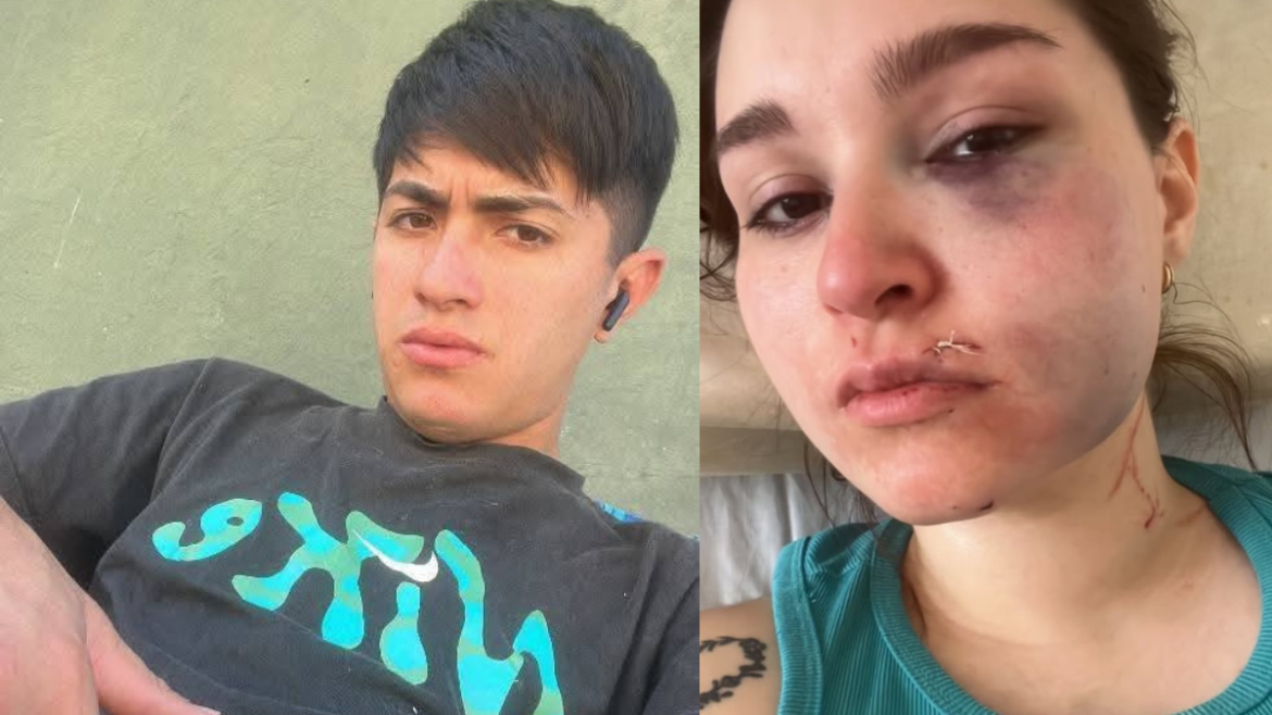 Una mujer denunció que su pareja la atacó la golpeó, atacó con un cuchillo y le cortó la cara a su beba de un año