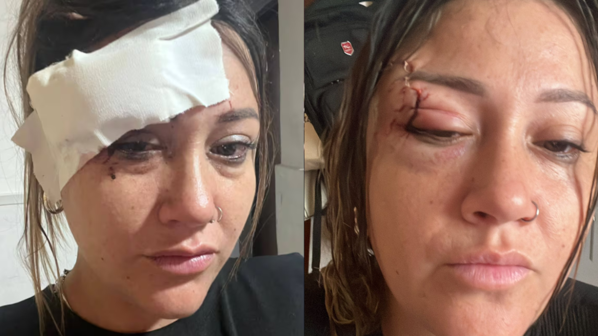 Enfrentó a un hombre que acosaba menores en un cumpleaños de 15 y el sujeto le cortó la cara