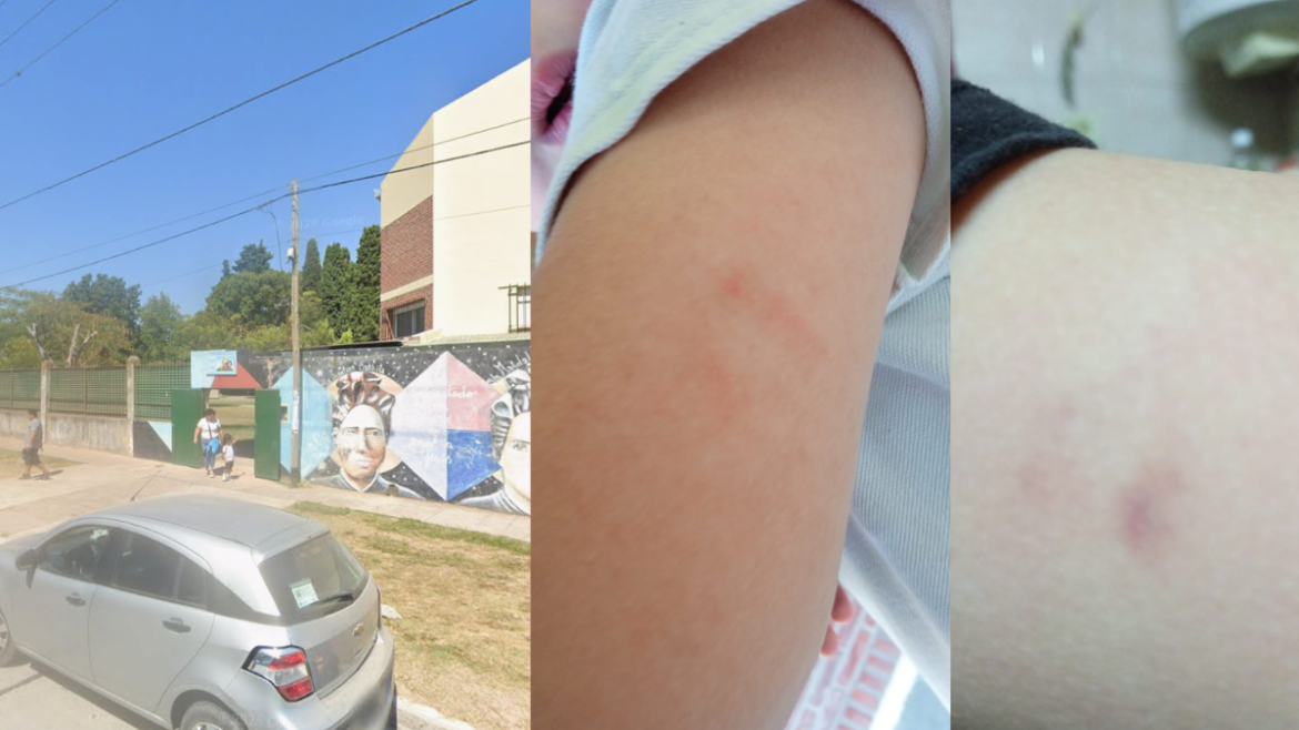 Denuncian que un nene de 5 años fue golpeado por una docente en un jardín de La Plata