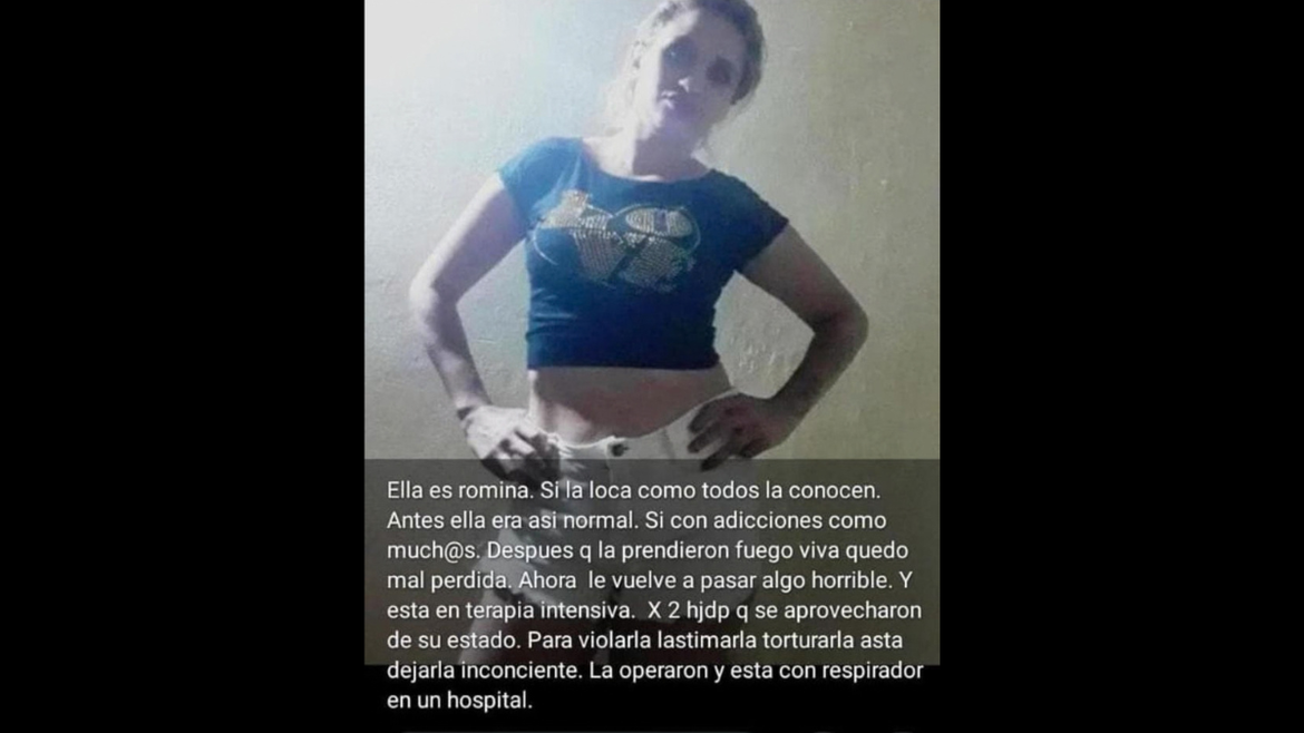 Una mujer está internada en estado crítico y la Justicia intenta reconstruir qué ocurrió en Los Hornos